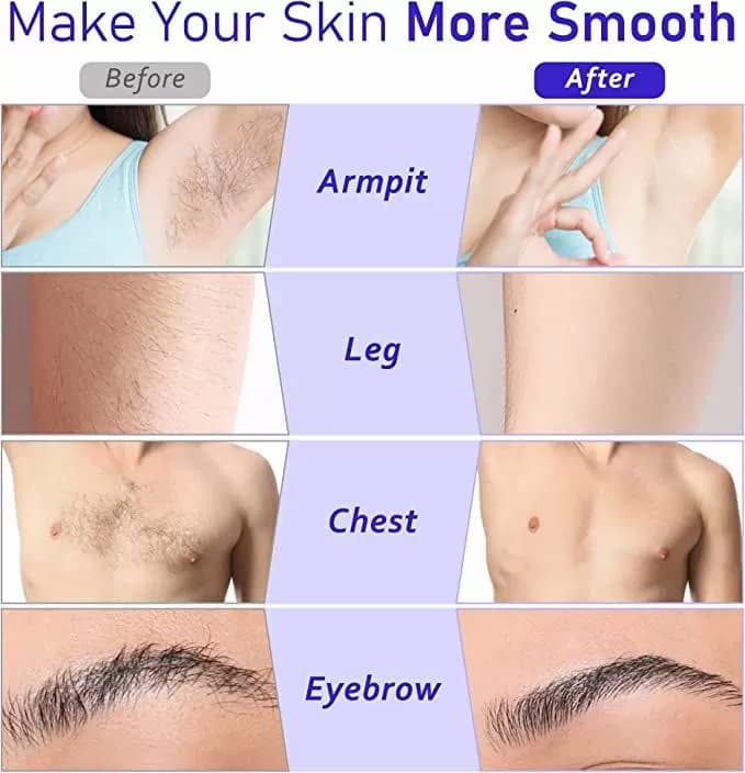 3 In 1 Depilatory Wax Warmer Roller (No More Expensive Salon Visits)