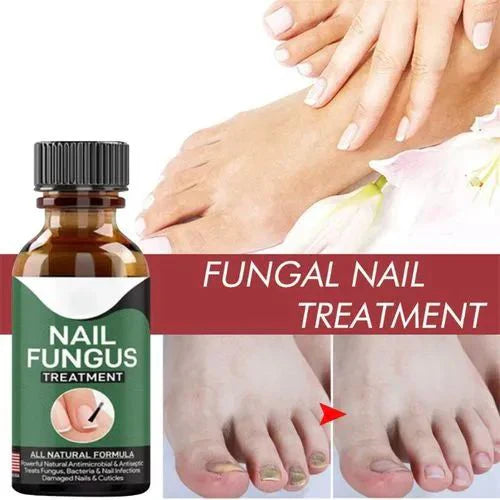 Nail Fungus Treatment -Advanced Antifungal Treatment